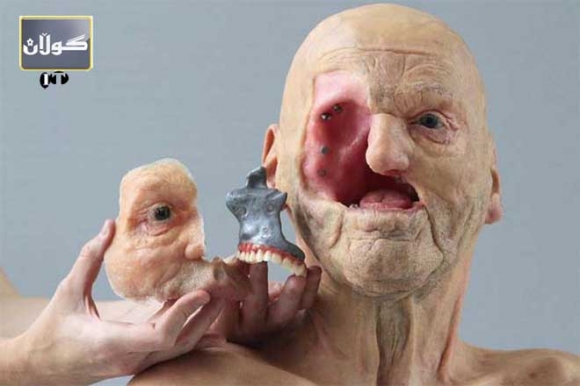 پرێنتەرێكی 3D كارێك بۆ كەم ئەندامان